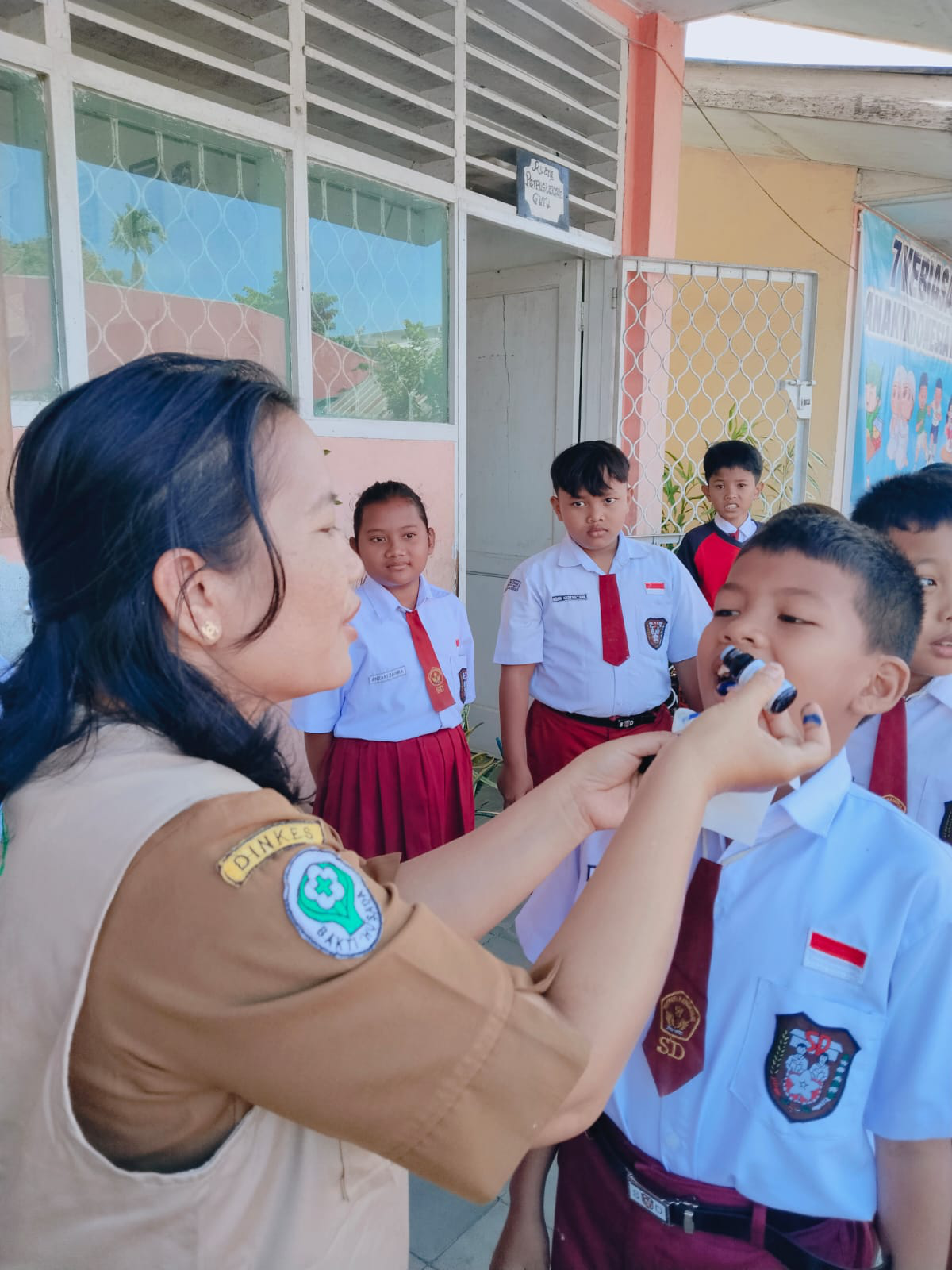 Pemberian Topikal Fluor, Cegah Gigi Karies